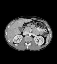 Abdomen-phantom-508-02_4