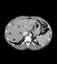 Abdomen-phantom-508-05_2