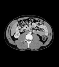 Abdomen-phantom-508-08_6