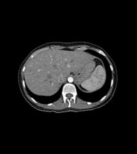 Abdomen-phantom-509-01_1
