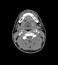 head-phantom-502-03_3