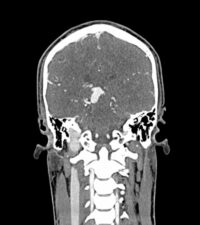 head-phantom-502-03_5