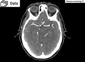 Related data image